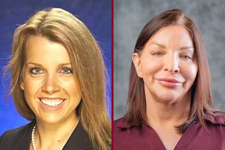 Jayne Jennings Dunlap, DNP, APRN, and Alex Klacman, PhD, RN, reflect on Nurses Week