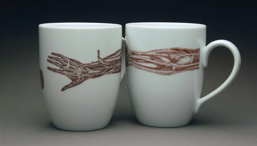 2 mugs with an anatomy illustration of an arm stretching across 